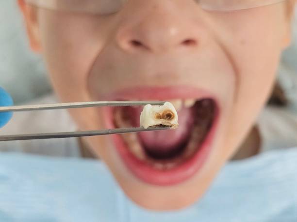 Best Knocked-Out Tooth Emergency  in Prairie Grove, IL